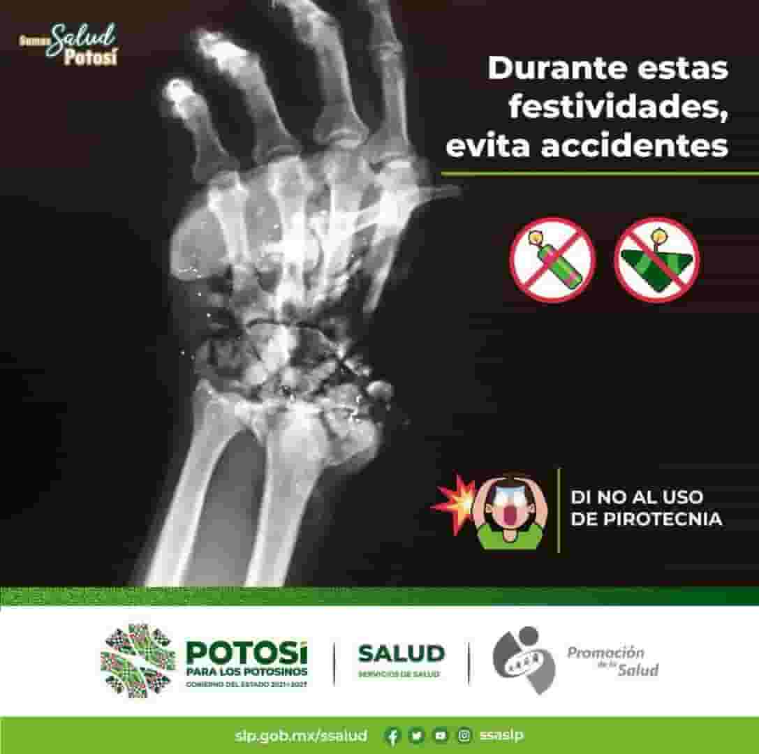 IMG-20241223-WA0031-min